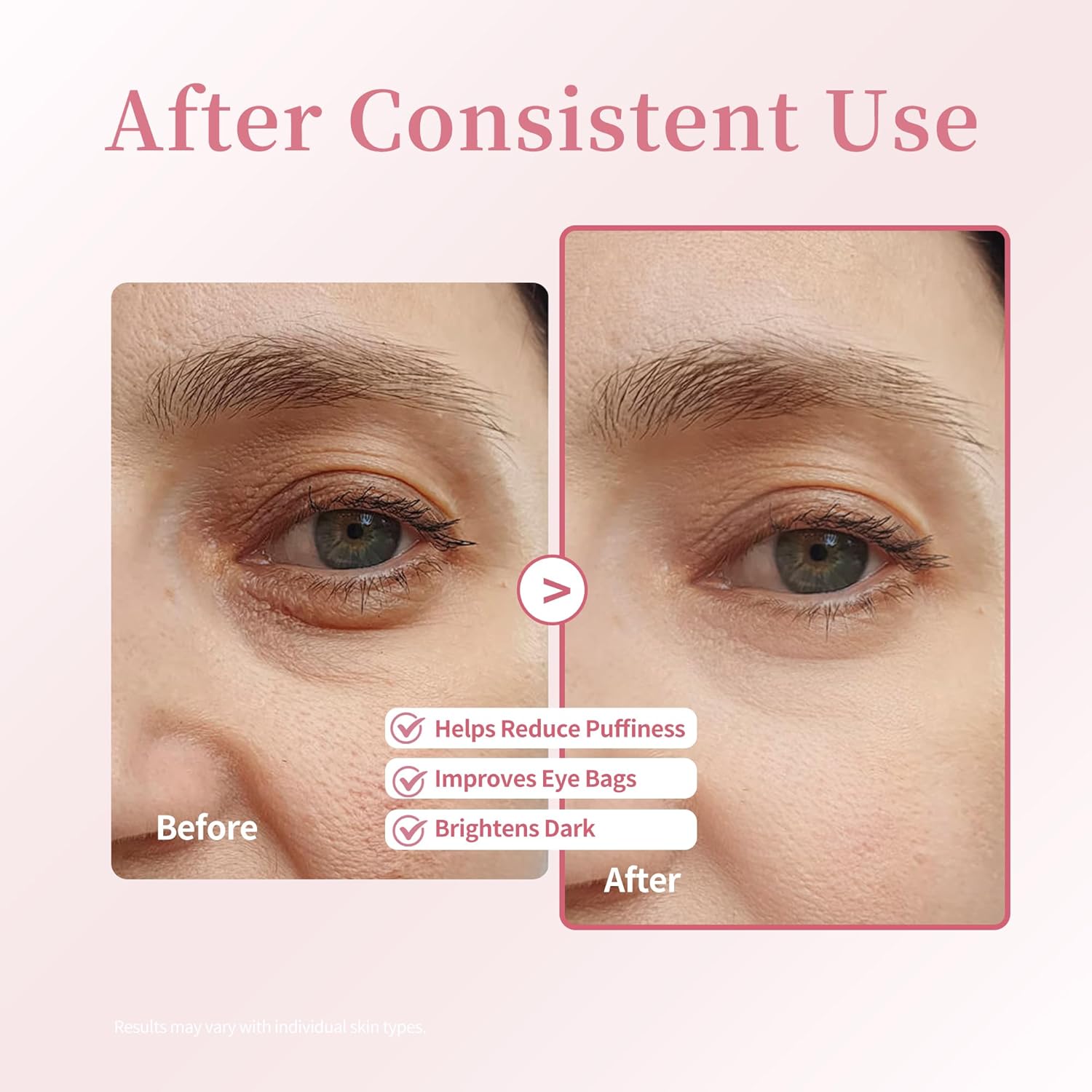Suero de retinol y cafeína para debajo de los ojos, crema refrescante Xenjura para ojos hinchados y ojeras, removedor de arrugas antienvejecimiento para líneas finas, cuidado de la piel vegano (0.7 fl